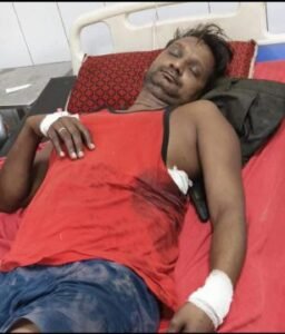 अयोध्या8जून25*चाट खाने के बाद पैसे मांगने पर तीन नशेड़ियों ने चाकू से हमला कर किया घायल, जिला रेफर