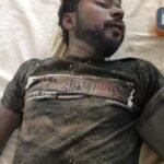 अयोध्या13जून25*अनियंत्रित बाइक तालाब में गिरी, दो घायल, हालत गम्भीर, दर्शन नगर रेफर