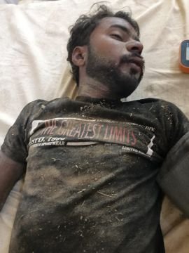 अयोध्या13जून25*अनियंत्रित बाइक तालाब में गिरी, दो घायल, हालत गम्भीर, दर्शन नगर रेफर