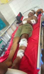 अयोध्या 23जुलाई25* मामूली कहा सुनी के विवाद में युवक को बंधक बना कर पीटा, मरा समझकर फेका*