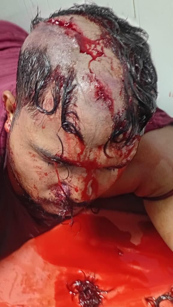 कानपुर24जुलाई25*एक दर्ज़न गुंडों ने बीच चौराहे युवक पर किया जानलेवा हमला। कानपुर24जुलाई25*एक दर्ज़न गुंडों ने बीच चौराहे युवक पर किया जानलेवा हमला।