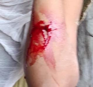 कानपुर नगर5अगस्त25*शिवराजपुर कस्बे के वार्ड 3 में दबंगों का महिलाओं पर कहर जारी। कानपुर नगर5अगस्त25*शिवराजपुर कस्बे के वार्ड 3 में दबंगों का महिलाओं पर कहर जारी।