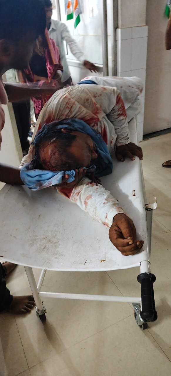 हरदोई18अगस्त25*पूर्व लेखपाल पर जानलेवा हमला, मेडिकल कालेज रेफर हरदोई18अगस्त25*पूर्व लेखपाल पर जानलेवा हमला, मेडिकल कालेज रेफर