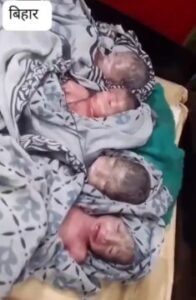 पूर्णिया24सितम्बर25*नवरात्र के दौरान पूर्णिया में चमत्कार ! महिला ने एक साथ चार बच्चियों को दिया जन्म...