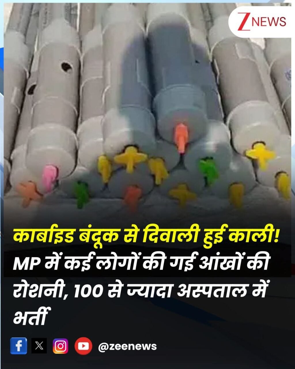 भोपाल24अक्टूबर25*कार्बाइड बंदूक से दिवाली हुई काली! MP में कई लोगों की गई आंखों की रोशनी, भोपाल24अक्टूबर25*कार्बाइड बंदूक से दिवाली हुई काली! MP में कई लोगों की गई आंखों की रोशनी,