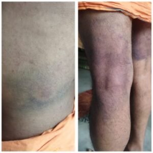 कौशाम्बी1अक्टूबर25*6 उप निरीक्षकों ने मिलकर एक फॉलोअर को पीटा उप निरीक्षकों के वीरता पर लगा ग्रहण*