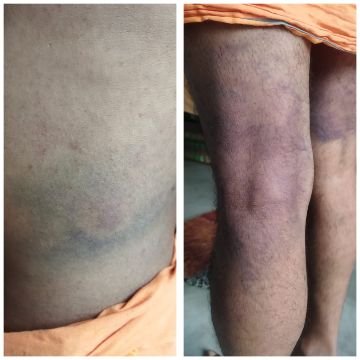 कौशाम्बी1अक्टूबर25*6 उप निरीक्षकों ने मिलकर एक फॉलोअर को पीटा उप निरीक्षकों के वीरता पर लगा ग्रहण*