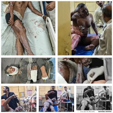 कानपुर नगर8अक्टूबर25*कानपुर में विस्फोट का मामला -* कानपुर नगर8अक्टूबर25*कानपुर में विस्फोट का मामला -*