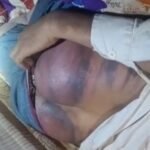 लखीमपुर खीरी26अक्टूबर25*दलित युवक की दबंगों ने की बेरहमी से पिटाई।