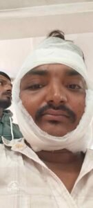 कौशाम्बी 12/11/2025*सड़क हादसे में पत्रकार घायल*