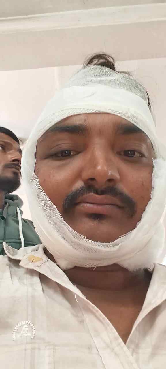 कौशाम्बी 12/11/2025*सड़क हादसे में पत्रकार घायल* कौशाम्बी 12/11/2025*सड़क हादसे में पत्रकार घायल*