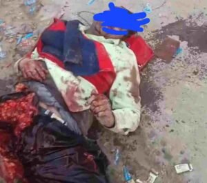 हरदोई 11नवम्बर 25*जानवरों के आतंक से कई व्यक्ति घायल,दो तीन घायल व्यक्तियो की इलाज ले जाते समय पर हुई मौत