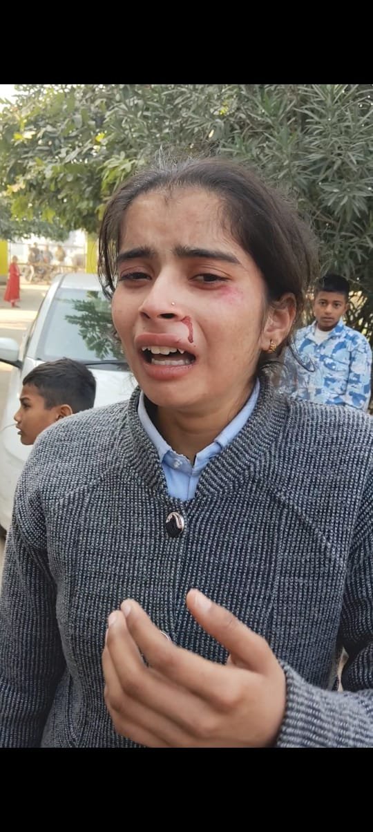 आगरा 06सितम्बर 25*के सैया थाना क्षेत्र स्थित पंडित मूंगा राम बाबूजी इंटर कॉलेज में दो चोटी न बनाने पर छात्रा को शिक्षकों ने बेरहमी से पीटा।