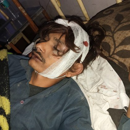 कानपुर नगर 10 दिसम्बर 25*बिल्हौर थाना क्षेत्र में दबंग होमगार्ड ने एक युवक बेरहमी से पीटा।