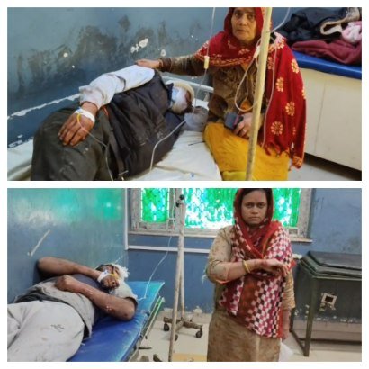 बाँदा10दिसम्बर 25*कलयुगी बेटे व बहू ने शिक्षक पिता पर पत्थर से वार कर किया लहूलुहान,