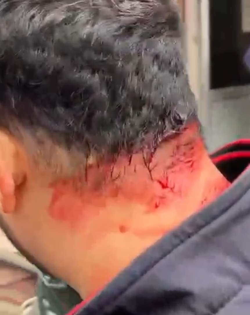 कानपुर नगर 21दिसम्बर 25*अंतिम संस्कार से लौट रहे आदित्य सिंह नाम के युवक पर ईट पत्थर से हमला*