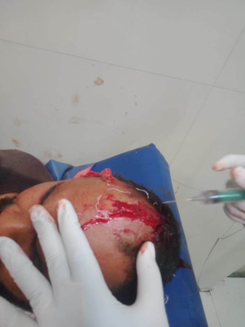 लखनऊ २८ दिसंबर २५ * मड़ियाव में युवकों पर जानलेवा हमला, ईंट-पत्थर से पिटाई, एक की हालत गंभीर। .