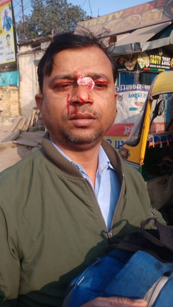 वाराणसी 14 जनवरी 26 * पुलिस की रोकथाम के बाद भी चायनीज मंझे की चपेट