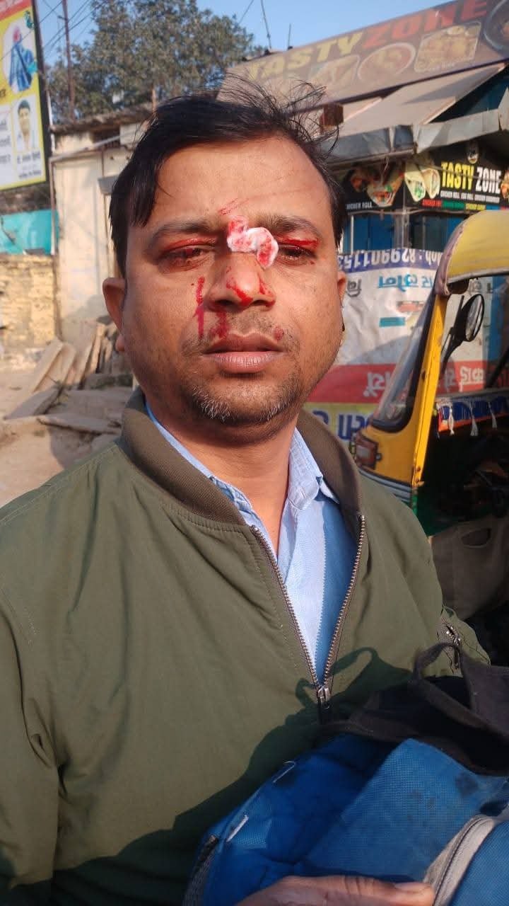 वाराणसी 14 जनवरी 26 * पुलिस की रोकथाम के बाद भी चायनीज मंझे की चपेट