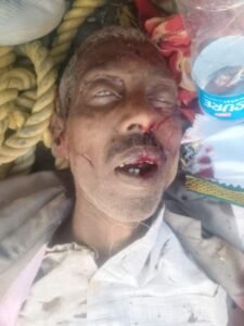 बांदा 22 फरवरी 26*ट्रैक्टर व ई-रिक्शा की टक्कर, बड़ागांव के वृद्ध की मौत, 3 गंभीर घायल*