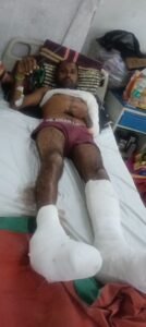 कौशाम्बी ८ फरवरी २६*ठेकेदार ने मार मारकर मजदूर का तोड़ा हाथ मुकदमा दर्ज*