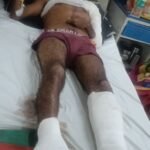 कौशाम्बी ८ फरवरी २६*ठेकेदार ने मार मारकर मजदूर का तोड़ा हाथ मुकदमा दर्ज*