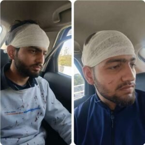 सहारनपुर 1 मार्च 2026*बिहारीगढ़ में दिन निकलते ही दबंगों ने होली के रंगों की दुकान लगा रहे दो सगे भाइयों को जमकर पीटा, थाने में तहरीर...*