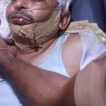 बांदा18मार्च26*सुरेंद्र कुमार S/oमहादेव निवासी डीएम कॉलोनी का हों गया दर्दनाक एक्सीडेंट**