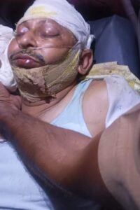 बांदा18मार्च26*सुरेंद्र कुमार S/oमहादेव निवासी डीएम कॉलोनी का हों गया दर्दनाक एक्सीडेंट**