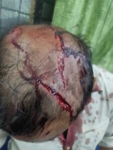 मुजफ्फरनगर 21 मार्च 26*कश्यप समाज में भारी उबाल,पुलिस की ढीली कार्रवाई पर फूटा गुस्सा