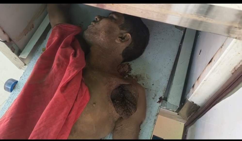 भागलपुर 22 अप्रैल 26*शरीर पर दर्जनों वार, पेट तक चीरा नवगछिया में दिल दहला देने वाली हत्या*