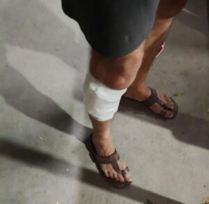 कानपुर नगर23मई26*काकादेव थाना अंतर्गत शास्त्री नगर क्षेत्र में सुतली बम से हमला, युवक हुआ घायल*