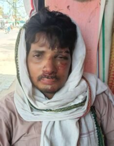 कानपुर नगर23मई26*घर लौट रहे युवक पर हमला, 20 हजार छीने : युवक के चेहरे पर गंभीर चोट
