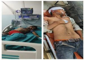 सुल्तानपुर21जुलाई26*सिर पर धारदार हथियार से हमला, लाठी-डंडों से पीटने का आरोप; पीड़ित लखनऊ ट्रॉमा सेंटर के आईसीयू में भर्ती, 