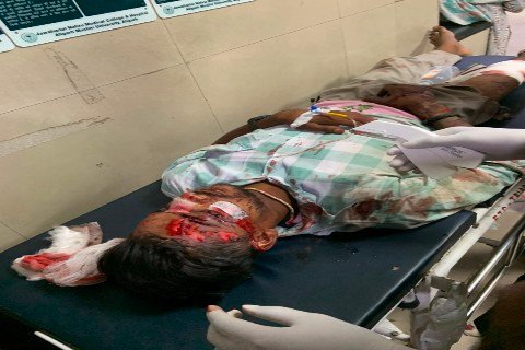 अलीगढ़19अगस्त26* अतरौली में मोबाइल ब्लास्ट से हड़कंप, फ्लिपकार्ट डिलीवरी बॉय झुलसा