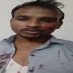 लखनऊ 13 सितंबर 26*पत्रकार मुकेश कुमार पर धारदार हथियार से जानलेवा हमला, 5 पर तहरीर*