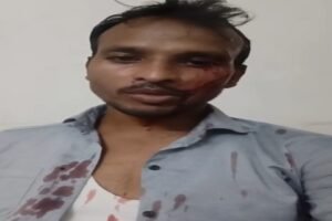 लखनऊ 13 सितंबर 26*पत्रकार मुकेश कुमार पर धारदार हथियार से जानलेवा हमला, 5 पर तहरीर*