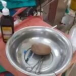 कानपुर नगर 7 अक्टूबर 26*जल्दबाजी और जल्द राहत पाने के चलते बवासीर की सिकाई हो सकती थी जानलेवा,